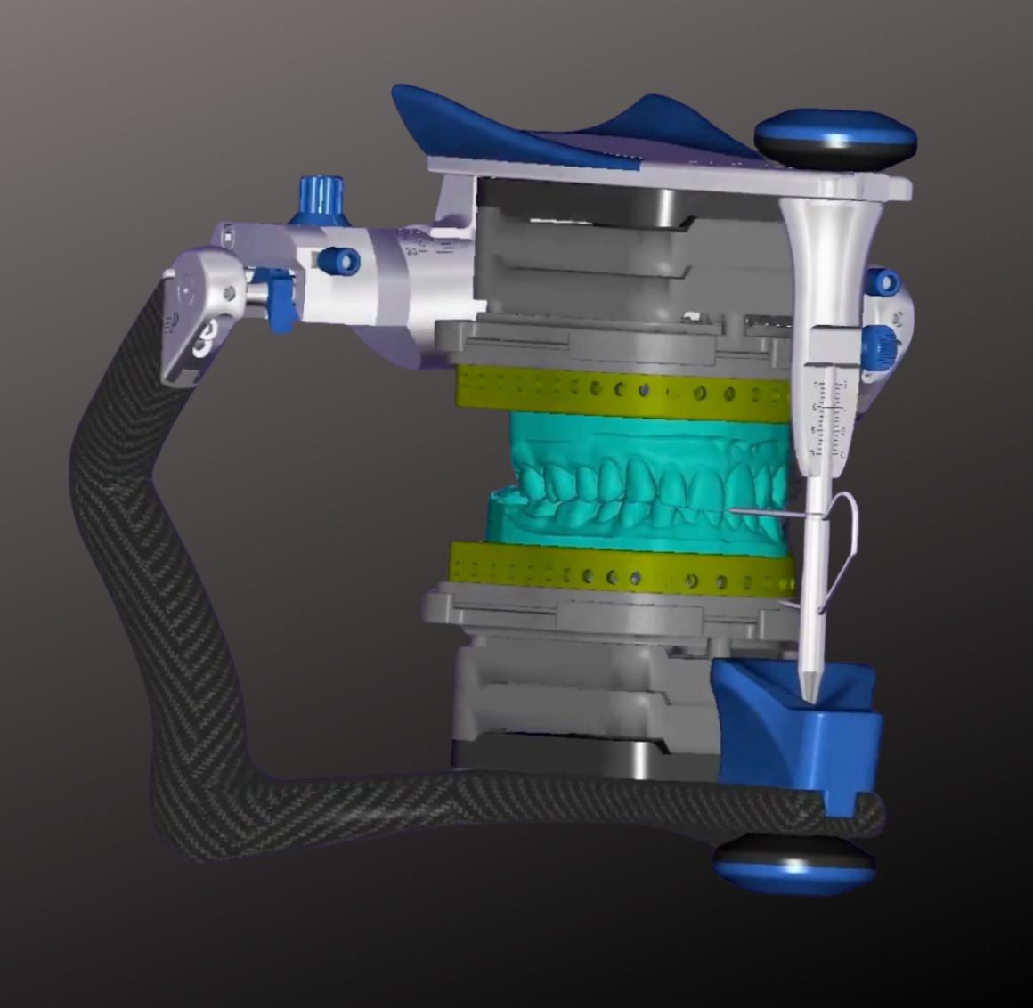 REVO DIGITAL